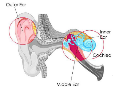 Mixed Hearing Loss